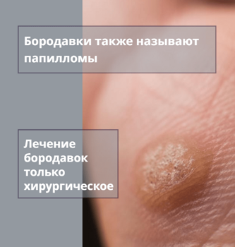 Что такое бородавки? Клиника ЛазерМед в Омске