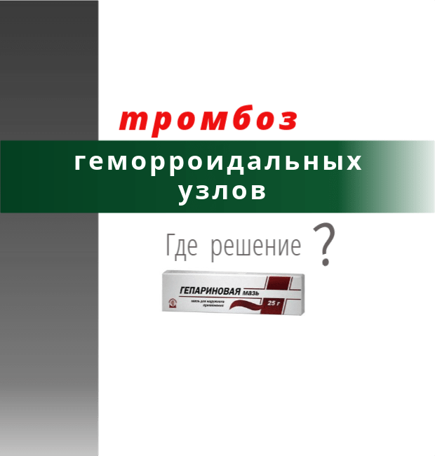 Тромбоз геморроидального узла: лечение, диагностика, симптомы